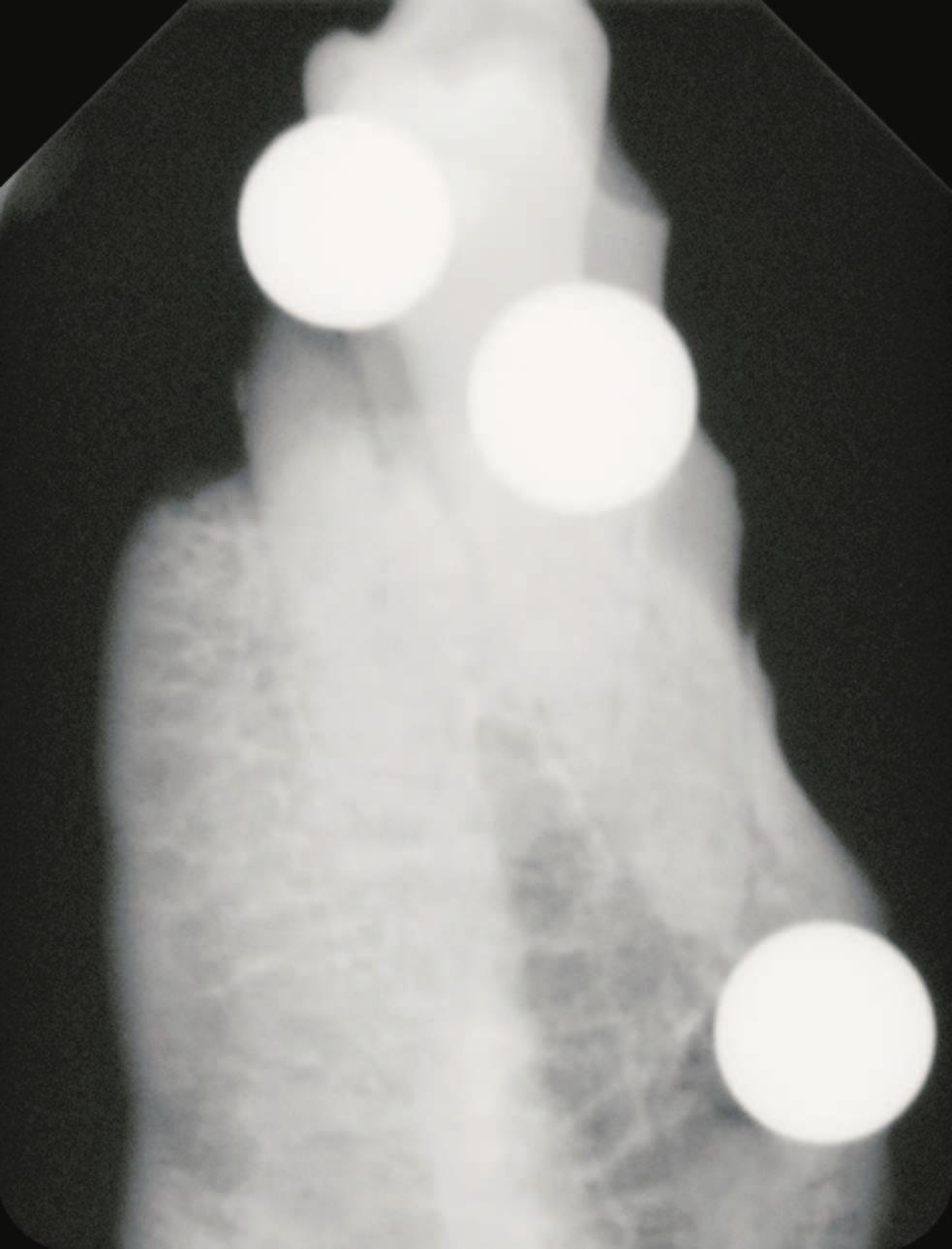 4.4 Finden von projizierten Ellipsen in Röntgenbildern geln die Röntgenstrahlung stark absorbieren, setzt sich die Kugel kaum von ihrer Umgebung ab (siehe Abbildung 4.9 a).