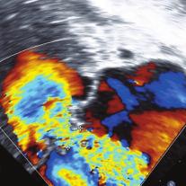 Darüber hinaus möchten wir Ihnen einen inblick in klinisch relevante und neue Untersuchungsmethoden (3-D-cho, Gewebedoppler und