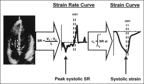 Einleitung 7 Der Strain erscheint weniger anfällig gegenüber Überlagerungsgeräuschen, da zufällige, kurze Geschwindigkeitsänderungen durch die Integration ignoriert werden.