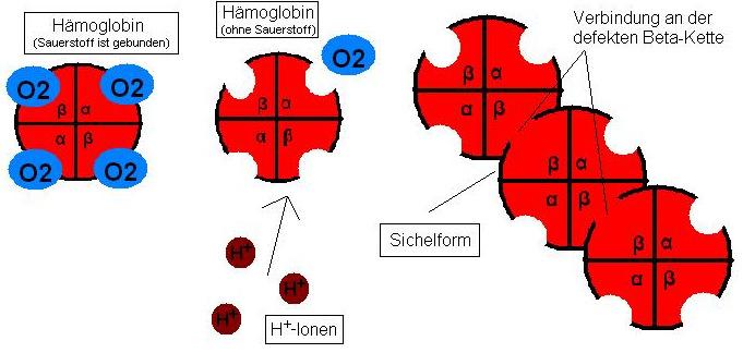 Hämolytische Anämie