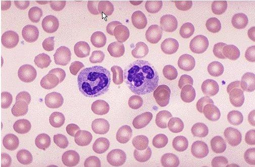 Blutzellen Blutzellen Zahl (pro µl Blut) Leukozyten 6 000-8 000 Granulozyten Neutrophile Eosinophile Basophile Lymphozyten Monozyten Erythrozyten Frau: