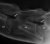 3 Latero- laterale Röntgenaufnahme von C5 bis C7 am Beispiel des Skeletts, durch Drehen des Bildausschnitts (rot markiert) in Pfeilrichtung wird die Änderung des Bildausschnitts durch Positionierung