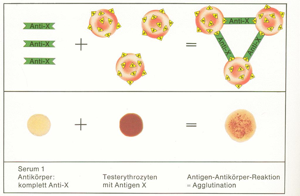 Antigen-Antikörper-Reaktionen Komplette