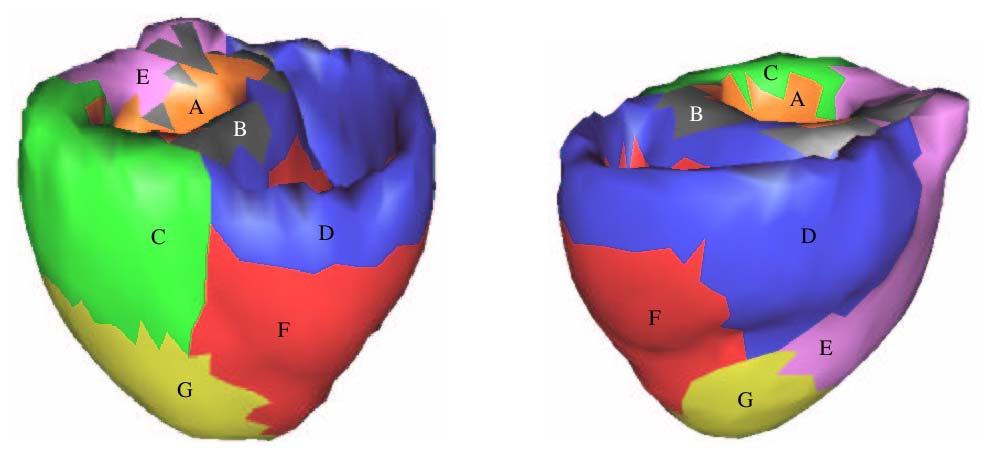Anatomische Bereiche A: Basis der linken Endokardkammer B: Basis des Septums C: Dorsobasis der linken Epikardkammer D: Basis