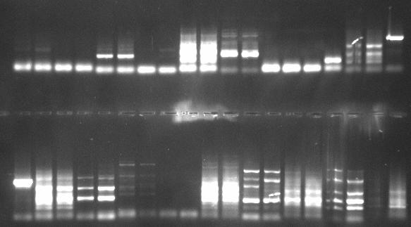 Primerpaar 2: I und II: PR-Produkte von genomischer DNA) und zwei Plasmiden (III und IV: PR-Produkte der Plasmide: Spastin Wildtyp und Spastin Mut. p.388k>r) getestet.
