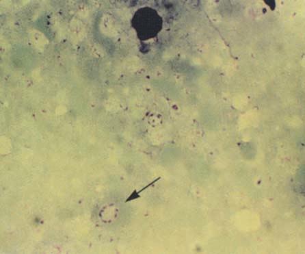20: Blastocystis hominis (HEIDENHAIN-Färbung; aus