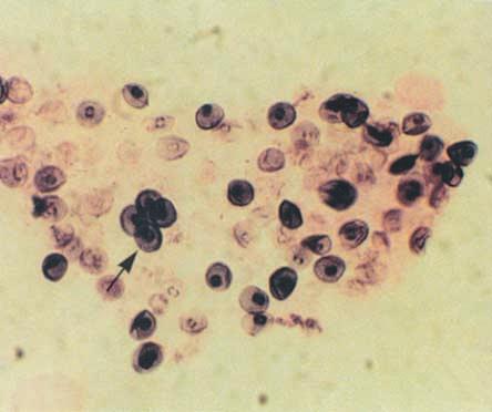 ASPÖCK 1994). 50µm Abb.