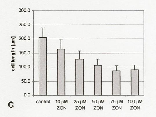 thaliana Col-0 Pflanzen wurden auf MS 4,5 % Medium kultiviert; in (A) wurde kein ZON, in (B) wurden 25 µm ZON addiert.