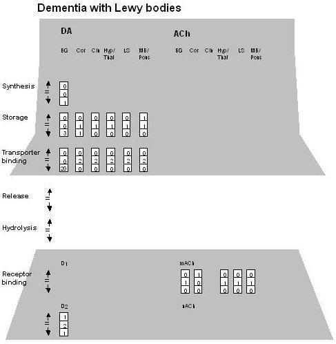 Lewy-Body-Demenz Dopamin: Präsynaptisch: Minderung der striatalen