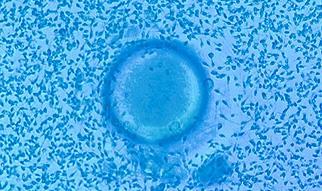 Dort können Sie sich so viel Zeit nehmen, wie Sie benötigen, um sich auszuruhen. Die entnommenen Eizellen werden in unserem Labor mit Hilfe der In-vitro-Fertilisation oder der ICSI-Technik befruchtet.