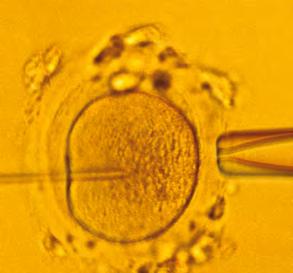 Nur speziell zur In-vitro-Fertilisation ausgebildete Ärzte dürfen tätig werden. Unsere Ausbildung entspricht den im Gesetz beschriebenen Anforderungen.