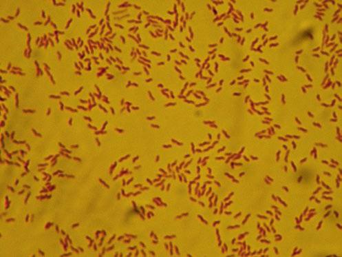 Wie ansteckend sind Campylobacter? Wie wird die Krankheit übertragen? Mikroskopische Aufnahme (Gramfärbung) von Campylobacter-Bakterien, Vergrößerung 1:1000 Was sind Campylobacter?