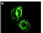 in Zellen I (Haut, Muskel) normal mutiert mutiertes Spastin hat geänderte Verteilung in der Zelle