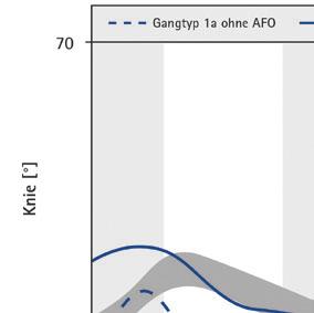 Abb. 3 Typisches Beispiel für Knie- und OSG-Winkelverläufe des hyperextendierten Gangtyps ohne AFO (gestrichelte Linie) und mit AFO (durchgezogene Linie).