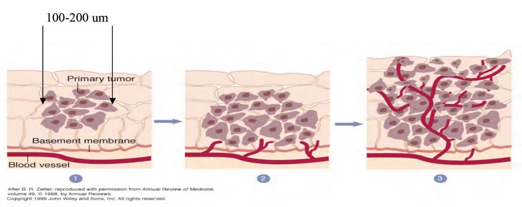 Exkurs: Angiogenese Ohne Angiogenese ist das Tumorwachstum