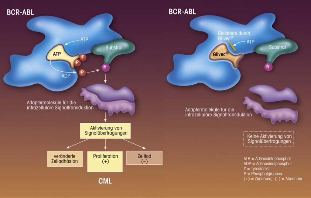 Imatinib Wirkmechanismus Imatinib-Therapie führt zu einem Abfall der CML-Zellen Imatinib hemmt die Bindung