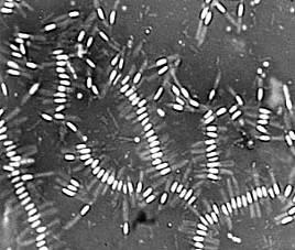 alvei - Enterococcus faecalis - Achromobacter