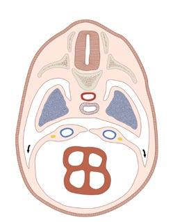 D Septum transversum (Pleuroperitonealmembran) A Übersicht über die Kompartimentierung des intraembryonalen Zöloms (nach Drews) Embryo im Alter von etwa 4 Wochen (Ansicht von links).