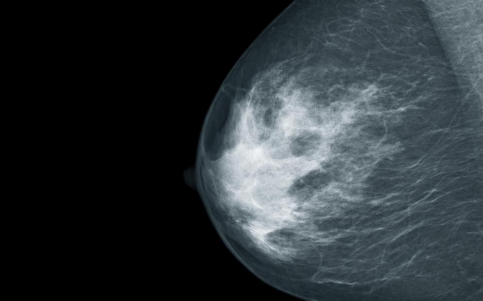 Bildqualität in der Mammographie Hinweise zur