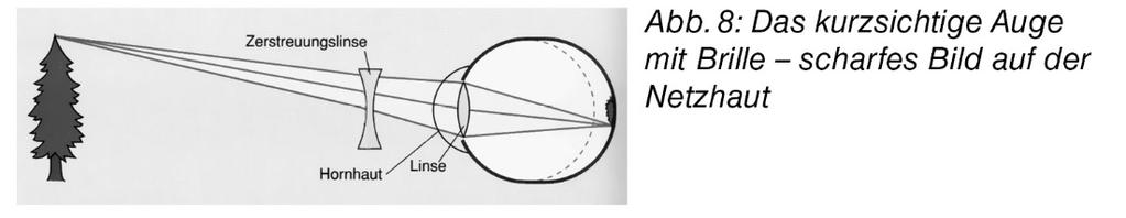 Die Stäbe der beiden Augenhalbschalen (1, 2) werden in je einen Klemmschieber gesteckt und die Halbschalen an einem Ende der Schiene wie abgebildet mit einem Abstand von ca. 4 cm aufgestellt.