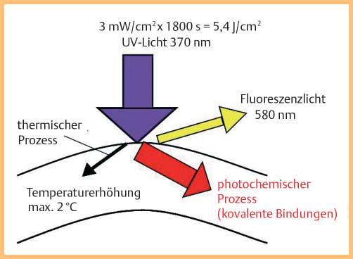 Bei der Vernetzung der Hornhaut führt die Lichtenergie zu einer chemischen Modifizierung des Kollagens.
