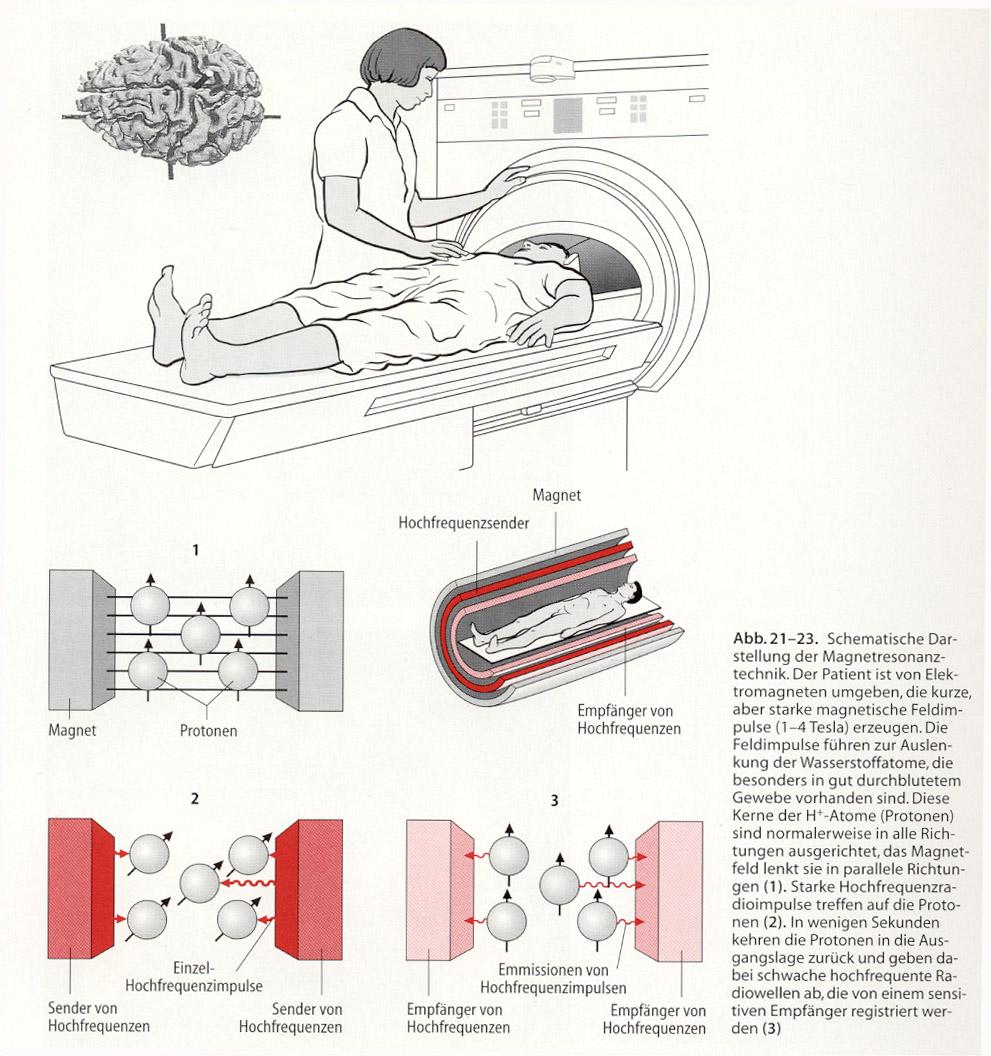 Magnetresonanztomographie (MRT / MRI) Erfassung der Dichte und