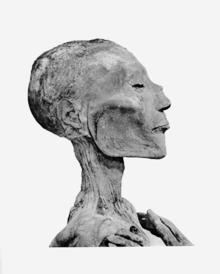 Geschichte der Virologie Erste Dokumentationen von Virusinfektionen Pharaoh Siptah verstarb 1193 vor