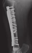 Auf dem Röntgenbild erschien die Knochenoberfläche ruhiger und es gab wenige periostale und endostale Reaktionen.