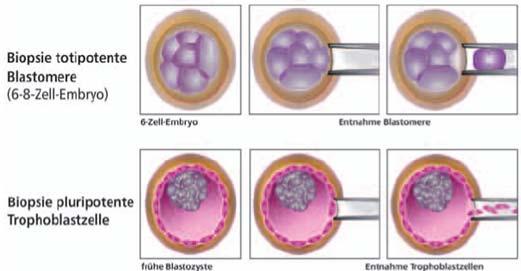 Trophoektodermbiopsie Blastomere: hohe Aneuploidierate, für Analyse von Translokationen oder monogenen Erkrankungen nicht