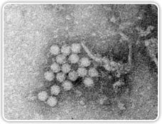 Porcines Circovirus Typ 2 http://www.pcvd.