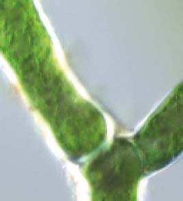 8 1 Die Pflanzenzelle Mutterzelle Tochterzellen Zellwand a Gallerte b Zellwand Gallerte Chloroplast c Zellwand