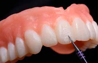 Workflow mit SR Vivodent CAD Ausarbeiten der Zähne Nach dem Fräsen und Schlichten der Prothesen in der Fräsmaschine können