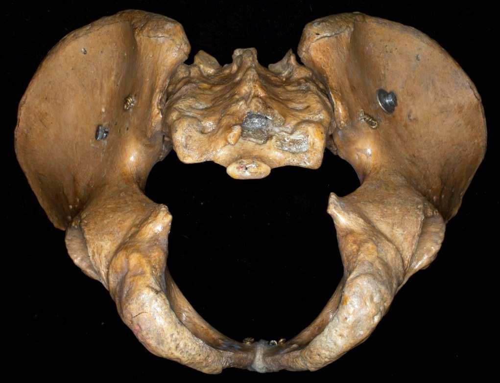 arcuata - Eminentia iliopubica - Pecten ossis pubis -