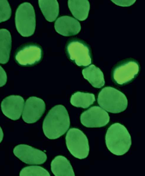 Autoantikörper gegen Zellkerne, Muster homogen (AC-1) zeigen eine homogene Fluoreszenz der Zellkerne.