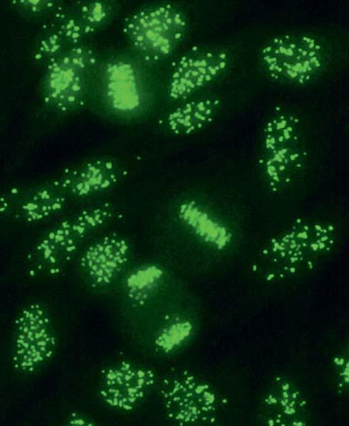 Autoantikörper gegen Zentromere (AC-3) Auf zeigt sich ein sehr spezifisches Fluoreszenzmuster, welches durch feine, gleich große Granula (in der Regel 46 oder 92 Zentromere je Zellkern)