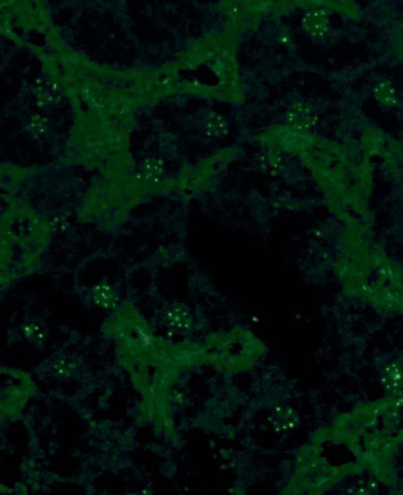 Die Granula der Interphase-Zellen sind gleichmäßig über den Zellkern verteilt, bei mitotischen Zellen sind sie je nach Stadium bandförmig in der Äquatorialebene (Metaphase) oder in zwei parallelen,