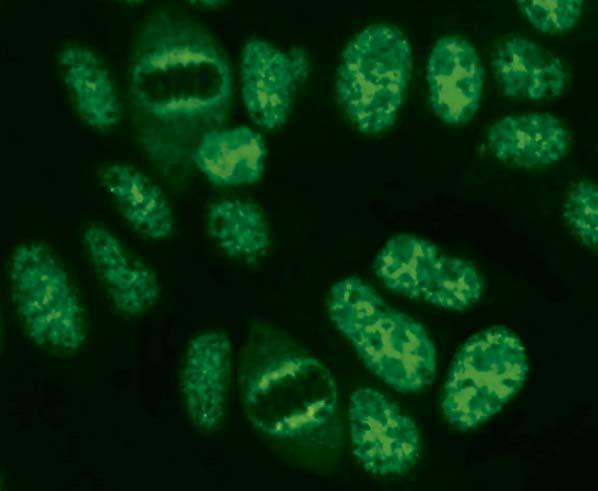 Autoantikörper gegen Nukleoplasma, feingranulär (AC-4) zeigen in der Interphase eine feingranuläre Fluoreszenz der Zellkerne.