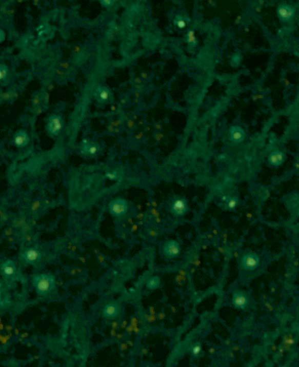 Mitotische Zellen weisen ebenfalls eine granuläre Fluoreszenz auf, unter Freilassung der Chromosomen.