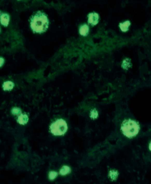 In Mitose-Zellen sind die kondensierten Chromosomen dunkel, perichromosomal zeigt sich eine fast homogene, glatte Fluoreszenz.