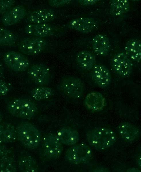 Autoantikörper gegen Nuclear Dots (AC-6) In der Immunfluoreszenz stellen sich mit in den Kernen der Interphase 6 20 unterschiedlich große Granula dar, die über den Zellkern verteilt sind (Nuclear