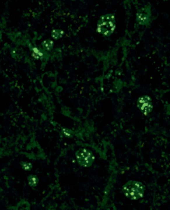 Bei den Mitosen sind die Nuclear Dots aufgelöst, außerhalb der (nicht angefärbten) Chromosomen fluoreszieren nur vereinzelte Granula.