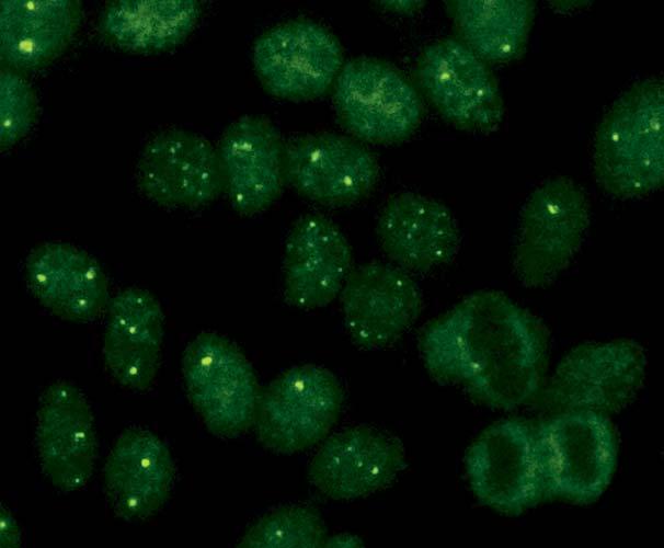 Autoantikörper gegen Few Nuclear Dots (AC-7) In der Immunfluoreszenz mit zeigen sich bei dem Muster Few Nuclear Dots lediglich 1 6 Punkte (dots) pro Zellkern oft in der