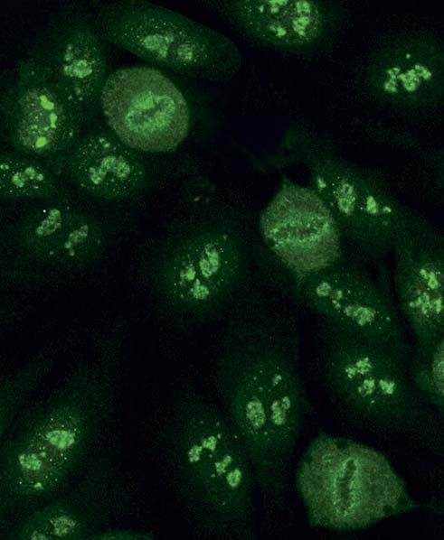 Autoantikörper gegen U3-nRNP / Fibrillarin (AC-9) Bei zeigt sich bei Interphase-Zellen eine granuläre