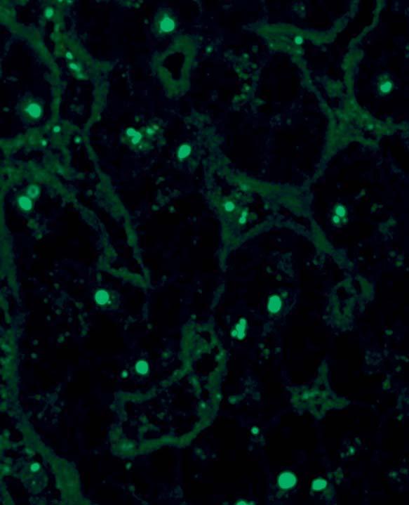 Bei gleichzeitigem Auftreten von Autoantikörpern gegen NOR-90 fluoreszieren bei mitotischen Zellen ein bis mehrere Pünktchen.