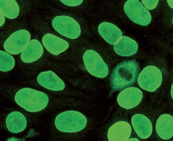 Autoantikörper gegen Kernmembran (AC-11 / AC-12) Bei zeigen die Interphase-Zellen eine homogene Fluoreszenz der Zellkerne,