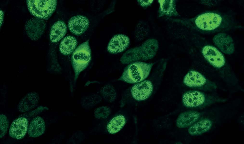 Autoantikörper gegen CENP-F (AC-14) Bei zeigt sich eine fein- bis grobgranuläre Fluoreszenz der Zellkerne. Dabei unterliegt die Intensität der Färbung starken Schwankungen.