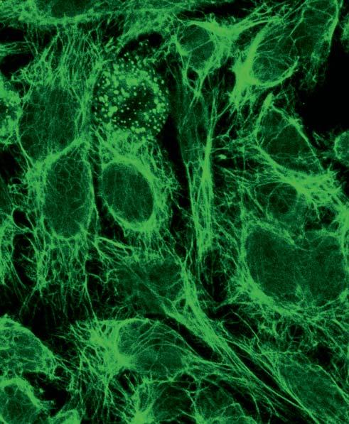Autoantikörper gegen Vimentin (AC-16) Antikörper gegen Vimentin färben im Cytoplasma der ein feines Fasergeflecht an, das in der Umgebung der Zellkerne besonders dicht ist.