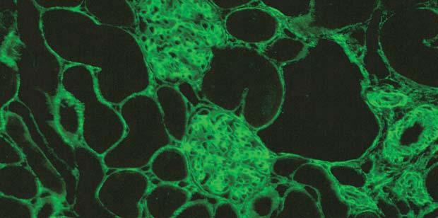 auf. Die Glomeruli und Tubuli der Rattenniere zeigen eine filamentöse Fluoreszenz.