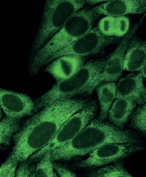 Autoantikörper gegen ribosomale P-Proteine (AC-19) Autoantikörper gegen ribosomale P-Proteine ergeben mit dem Substrat