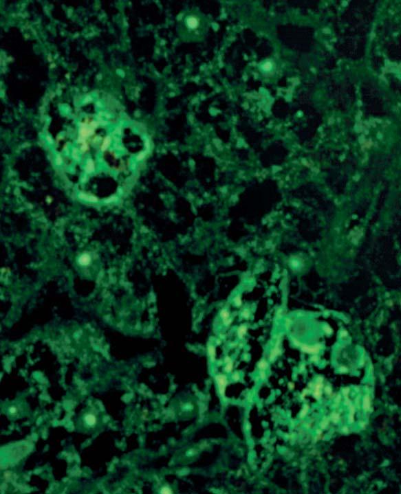 Hepatocyten der zeigen eine vollflächige cytoplasmatische Fluoreszenz mit fleckförmiger Betonung.
